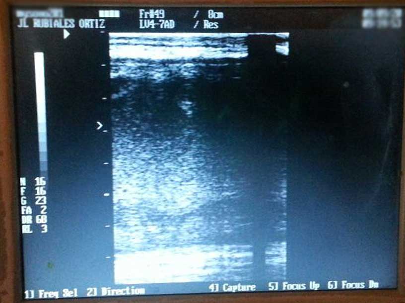 Cirugía de campo para caballos. En varios momentos de la intervención, se realiza un control ecográfico de la evolución de la cirugía